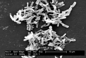 Alertă la Apa Serv! O nouă bacterie, ”organigramis pesedensis” pune Piatra Neamț pe jar