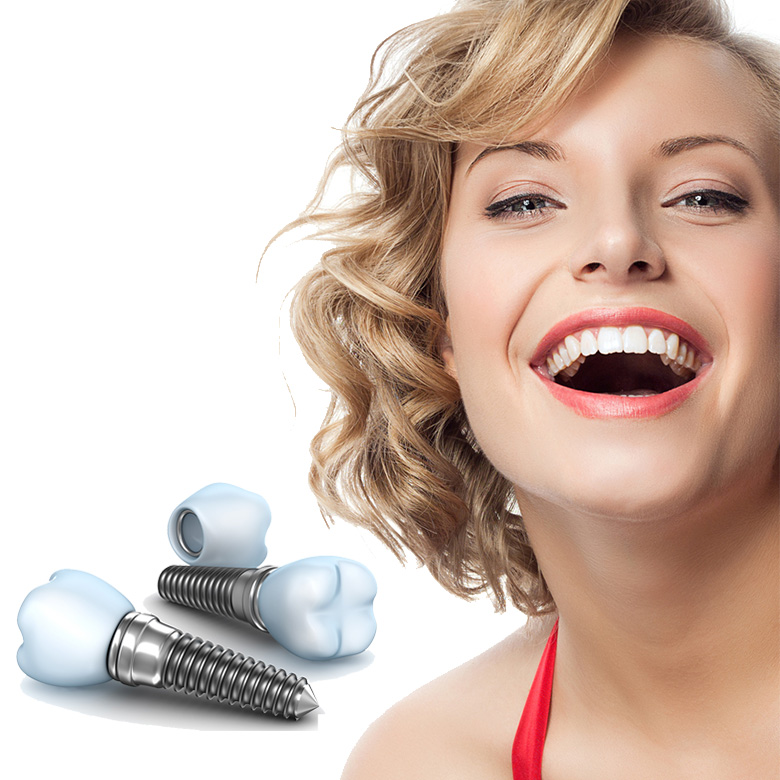 Te intrebi care implant dentar este cel mai bun? Iata raspunsul!