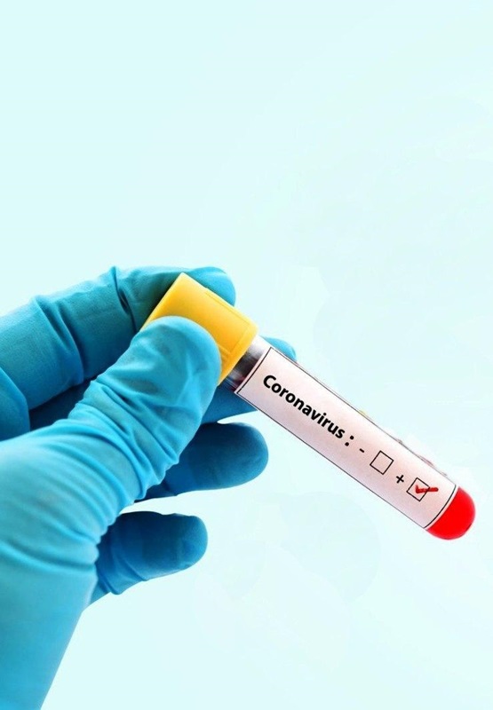 Coronavirus-4.jpg