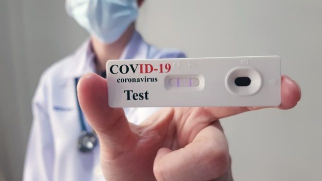 Testarea rapidă pentru coronavirus în farmacii ar putea începe peste minim 10 zile