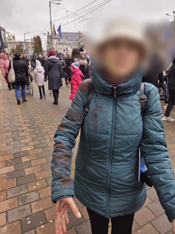 Piatra Neamț. Încă o persoană rănită după artificiile de Ziua Națională 1 WhatsApp Image 2025 12 01 at 16.43.06